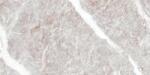 Marazzi Gresie portelanata, cu efect de marmura, Marazzi Allmarble Fior di Pesco Carnico MF6P Allmarble Fior di Pesco Carnico Rett (MF6P Allmarble Fior di Pesco Carnico Rett.)