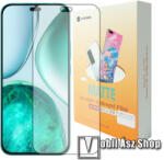 SUNSHINE Honor X8c, SUNSHINE Hydrogel TPU képernyővédő fólia, Anti-Glare, MATT! , 1db (SUNS315335)