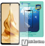 SUNSHINE Ulefone Note 18 Pro, SUNSHINE Hydrogel TPU képernyővédő fólia, Ultra Clear, ÖNREGENERÁLÓ! , 1db, a teljes képernyőt védi (SUNS315247)