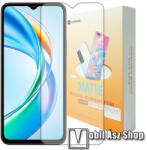 SUNSHINE Honor X5b, X5b Plus, SUNSHINE Hydrogel TPU képernyővédő fólia, Anti-Glare, MATT! , 1db (SUNS306321)