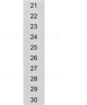 Siemens 8WH8140-2AB25 sorkapocs jelölő, 5, 2mm széles/2, 5mm2-hez, fehér, 21 . . . 30 (10x) (8WH81402AB25)