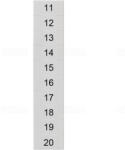 Siemens 8WH8140-2AB15 sorkapocs jelölő, 5, 2mm széles/2, 5mm2-hez, fehér, 11 . . . 20 (10x) (8WH81402AB15)