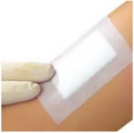 FPORE Ragtapasz FPORE szigetkötszer 6x7 cm