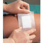 Lohmann & Rauscher Curapor sebtapasz 22121 (32913) 10 x 8 cm (50 db/dob) szigetkötszer steril (lohmann)