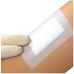 PORE Ragtapasz PORE szigetkötszer 10x15 cm - plazapatika