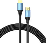 Vention ALHSL HDMI - HDMI Kábel - 10 m, Fekete