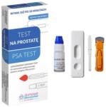  Prosztata teszt PSA