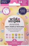 WILD Stripes Anti-Pimple Patches Smile Prevent 24 db