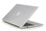 XPRO MacBook polikarbonát védő héj 2 az 1-ben átlátszó Macbook Air 11″ - extratelgsm - 7 990 Ft