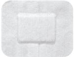 Matopat Fixopore S nem szőtt szigetkötszer 10x6cm 50 db