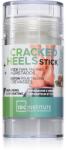 Idc Institute Cracked Heels Stick stick repedezett sarokra 70 g
