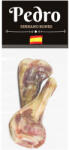Pedro Serrano Sertés Lábszárcsont
