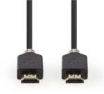 Nedis CVBW35000BK20 HDMI kábel 2 M HDMI A-típus (Standard) Fekete (CVBW35000BK20)