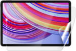 Screenshield XIAOMI Redmi Pad Pro védőfólia (XIA-REDMIPADPR-D)