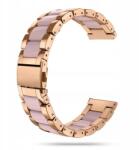  Női Karkötő Smartwatch Órához Univerzális 20MM Be-shield Szerszám (5903636816630)