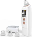 Beautifly B-Derma PRO Mikrodermabráziós készülék - Fehér (B-DERMA PRO) (B-DERMA PRO)