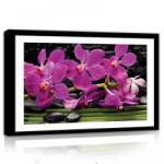 Consalnet Orchidea, vászonkép, 60x40 cm méretben (C5-11307O4)