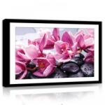 Consalnet Orchidea, vászonkép, 60x40 cm méretben (C5-11305O4)