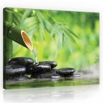 Consalnet Vászonkép, Zen, 100x75 cm méretben (C5-11407O1)