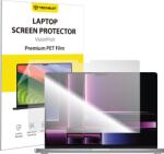 Techsuit MacBook Air 13" 2025 Clear Techsuit VisionProX Anti-Blue Light