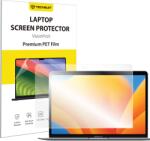 Techsuit MacBook Air 13" (2018/2017/2020) Clear Techsuit - VisionProX Anti-Blue Light