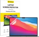 Techsuit MacBook Pro 14" 2024 Techsuit VisionProX Anti-Blue Light - Matt Átlátszó