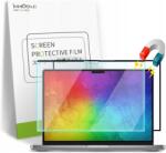 Amazon Mágneses Védőfólia Szűrővel Macbook Pro 14" 2021 A2442 És 2023 A2779 Modellekhez (334825978)