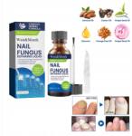  2 db-os intenzív körömgomba-kezelő csomag Javítja és erősíti a körmöket 60ml (al25100603)
