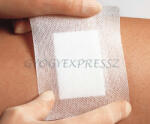 PORE ADHESIVE PORE 6 x 10 cm Steril szigetkötszer ragtapasz 1db