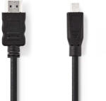 Nedis CVGB34700BK20 HDMI kábel 2 M HDMI A-típus (Standard) HDMI D-típus (Micro) Fekete (CVGB34700BK20)