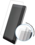 Eiger Протектор от закалено стъкло /Tempered Glass/ Eiger Tri Flex High Impact за Xiaomi Mi A1, 0.4mm, два броя (EGSP00277)