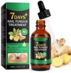 Nova Kiss Körömgomba kezelés gyömbérrel, serkenti a regenerációt és a növekedést, NOVA KISS®, 60 ml