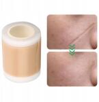  Szilikon Sebtapaszok Hegek, Műtét Utáni, Tekercs