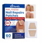  60 darabos gombaellenes körömjavító tapasz készlet (609287122018)