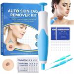  Bőrszemölcs eltávolító szett 2 az 1-ben (8581682984212)