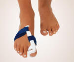 BORT 930010 bal M-es 38-41 hallux valgus (bütyök korrigáló) (3281)