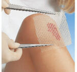 GRASSOLIND KENŐCSTÜLL 10 X 10 CM 10 db/doboz (U00003217)