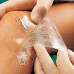 SUPRASORB F filkötszer 10 X 12 CM (410054217)