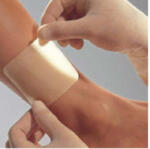 SUPRASORB SUPRASORB-H hydrokolloid kötszer 10x10 cm (410138710)