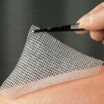 LOMATUELL H Kenőcstüll 10 X 20 Cm (410054592)