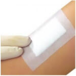 FPORE Ragtapasz FPORE szigetkötszer 9x25 cm (U00018938)