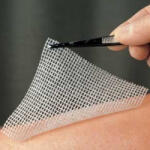 LOMATUELL kenőcstüll 10x10 cm (410054576)