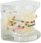 Verk Group Ortodontikus fogszabályozóval ellátott fogászati modell (27675)