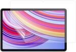  Védőfólia Xiaomi Redmi Pad Pro 4G/5G tablettákhoz Xiaomi Redmi Pad Pro 4G/5G (6604015598A)