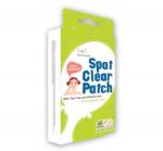 Cettua Tisztító szeletek a pattanások számára (8809033594270)