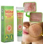  Atkák Eltávolító Krém Rüh Eltávolító Kenőcs Szeméremtetű Viszketés Elleni Kenőcs (VTTD467)