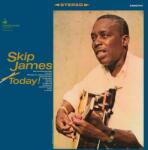 Skip James Today!
