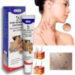  Szemölcs eltávolító krém - hatékony és fájdalommentes, egyéb szemölcsök eltávolítására is alkalmas, 1 db