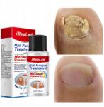  Körömgomba kezelésére szolgáló oldat Körömápoló esszencia 20 ml (6977793467058)