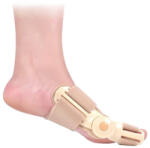 Rehab Bütyök korrigáló sín (1 pár) - Hallux valgus (930215)